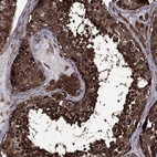 Anti-EIF2B4 Antibody