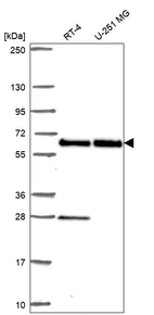 Western blot analysis in human cell line RT-4 and human cell line U-251 MG.