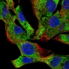 Immunofluorescent staining of human cell line Hep-G2 shows localization to endoplasmic reticulum.