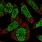 Anti-GLI1 Antibody