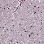 Immunohistochemical staining of human cerebral cortex shows nuclear positivity in glial cells.