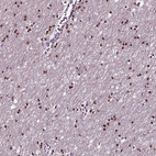 Anti-SOX10 Antibody