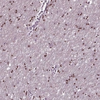 Immunohistochemical staining of human cerebral cortex shows nuclear positivity in glial cells.