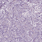 Anti-SOX10 Antibody