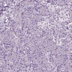 Immunohistochemical staining of human pancreas shows no positivity in exocrine glandular cells as expected.