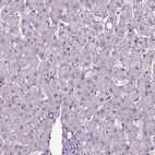 Immunohistochemical staining of human liver shows no positivity in hepatocytes as expected.