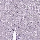 Immunohistochemical staining of human liver shows no positivity in hepatocytes as expected.