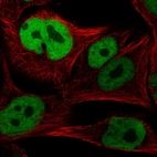 Immunofluorescent staining of human cell line SK-MEL-30 shows localization to nucleoplasm.