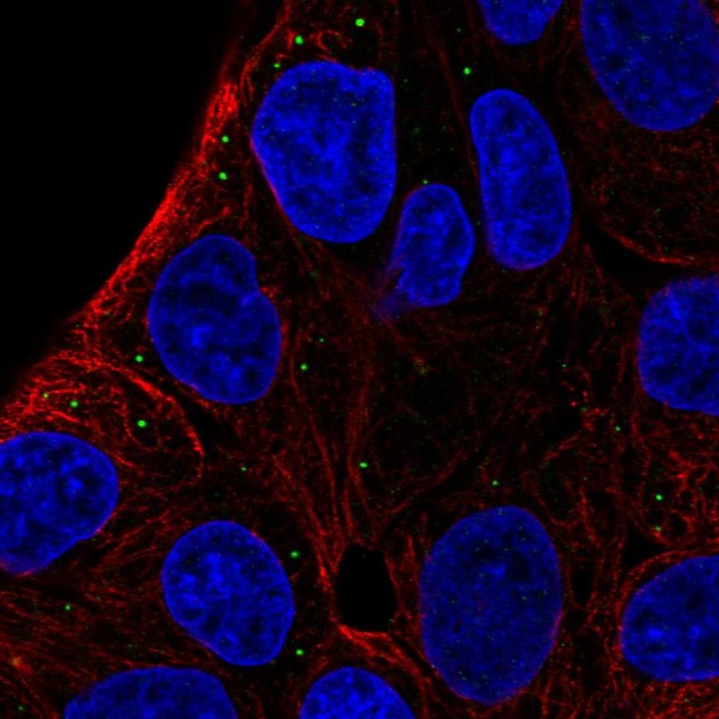 Anti-ST3GAL5 Antibody