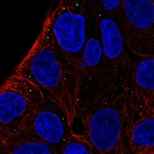 Anti-ST3GAL5 Antibody
