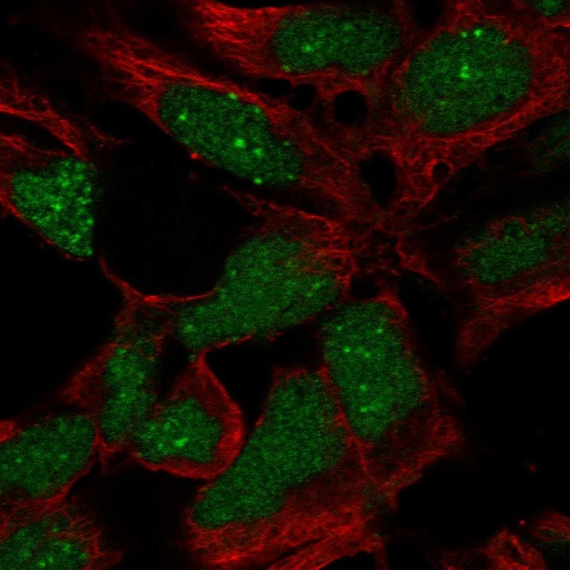 Anti-RP11-302B13.5 Antibody