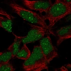 Anti-RP11-302B13.5 Antibody