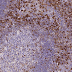 Anti-S100A4 Antibody