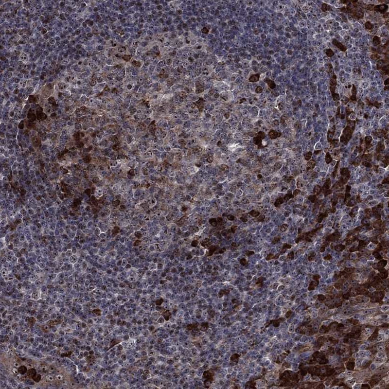 Anti-VHL Antibody