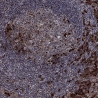 Anti-VHL Antibody