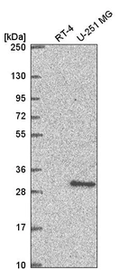 Anti-XRCC3 Antibody