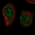 Immunofluorescent staining of human cell line RH-30 shows localization to nucleoplasm & cytosol.