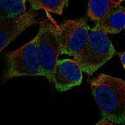 Anti-MSI2 Antibody
