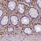 Immunohistochemical staining of human rectum shows strong cytoplasmic positivity in lymphoid cells.
