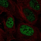 Anti-PAX3 Antibody