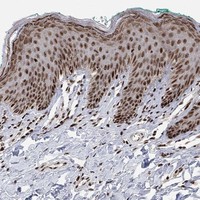 Anti-E4F1 Antibody