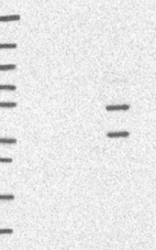 Lane 1: Marker [kDa] 250, 130, 95, 72, 55, 36, 28, 17, 10 | Lane 2: RT4 | Lane 3: U-251 MG | Lane 4: Human Plasma | Lane 5: Liver | Lane 6: Tonsil