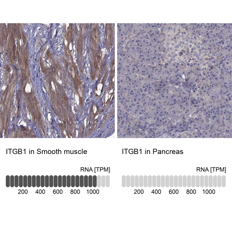 Anti-ITGB1 Antibody