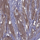 Immunohistochemical staining of human smooth muscle shows high expression.