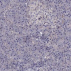 Anti-ITGB1 Antibody