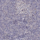 Immunohistochemical staining of human pancreas shows low expression as expected.