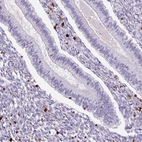 Immunohistochemical staining of human endometrium shows strong cytoplasmic positivity in lymphoid cells.