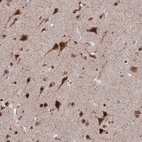 Anti-RFT1 Antibody