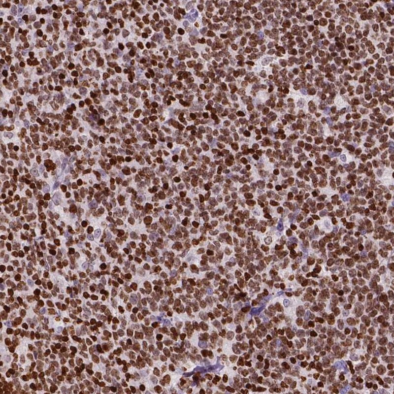 Anti-CBY3 Antibody