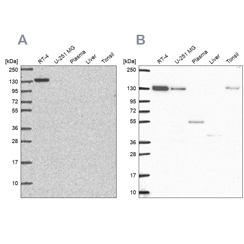 Anti-CAND1 Antibody