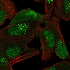 Immunofluorescent staining of human cell line RH-30 shows localization to nucleoplasm, cytosol & the Golgi apparatus.