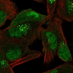 Immunofluorescent staining of human cell line RH-30 shows localization to nucleoplasm, cytosol & the Golgi apparatus.