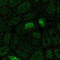 Anti-HOXA13 Antibody