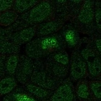 Anti-HOXA13 Antibody
