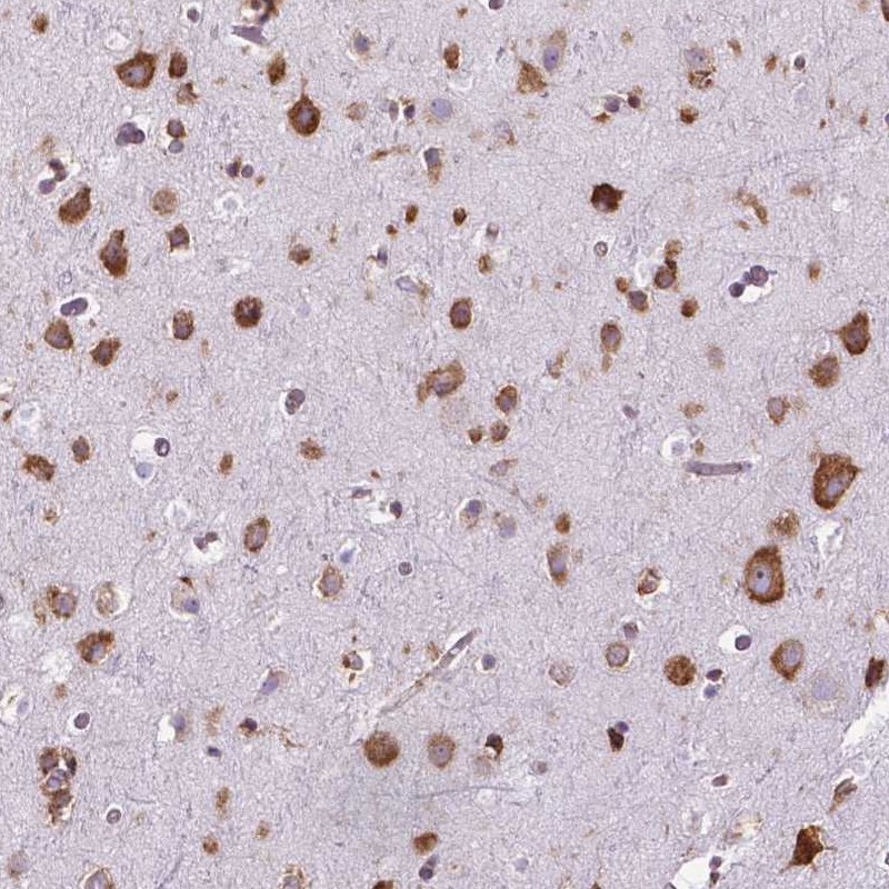 Anti-RPL29 Antibody