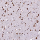 Anti-RPL29 Antibody