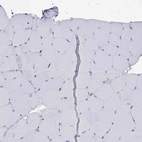 Immunohistochemical staining of human skeletal muscle shows low expression as expected.