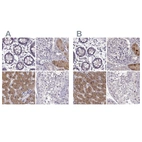 Immunohistochemical staining of human colon, kidney, liver and testis using Anti-ADH6 antibody HPA069081 (A) shows similar protein distribution across tissues to independent antibody HPA067946 (B).