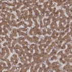Immunohistochemical staining of human liver shows high expression.