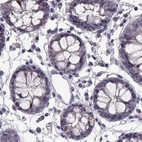 Immunohistochemical staining of human colon using Anti-ADH6 antibody HPA069081.