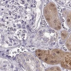 Immunohistochemical staining of human kidney using Anti-ADH6 antibody HPA069081.