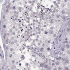 Immunohistochemical staining of human testis using Anti-ADH6 antibody HPA069081.