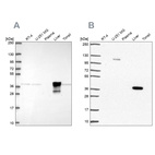 Western blot analysis using Anti-ADH6 antibody HPA069081 (A) shows similar pattern to independent antibody HPA067946 (B).
