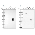 Western blot analysis using Anti-ADH6 antibody HPA069081 (A) shows similar pattern to independent antibody HPA067946 (B).