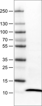 Lane 1: Marker [kDa]_br/_Lane 2: Human tonsil tissue lysate