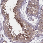 Immunohistochemical staining of human testis shows strong membranous positivity in cells in seminiferous ducts.